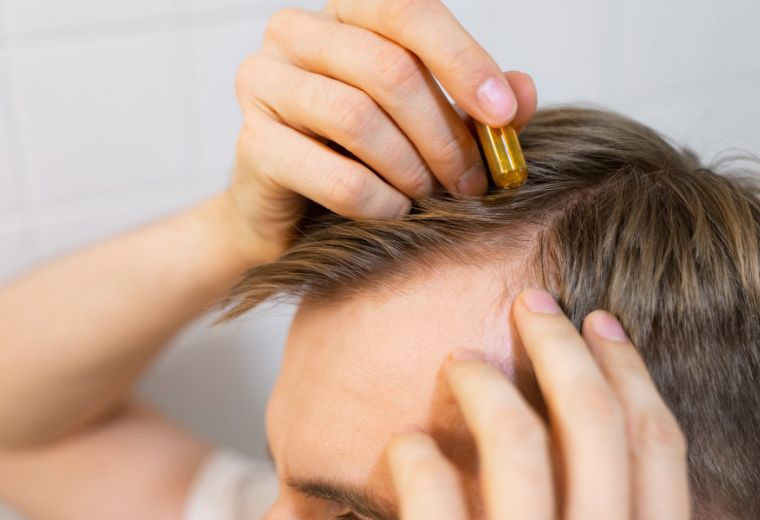Men Hair Loss Treatment Options