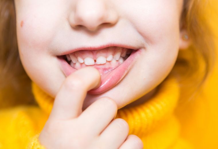 Where to Buy Anbesol Teething Gel